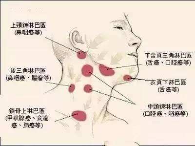 急性淋巴結炎