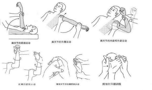 肢體癱瘓