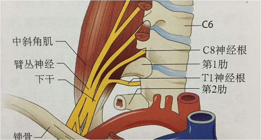 胸廓出口綜合癥