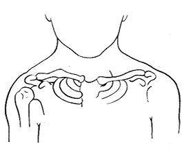 先天性骨與關(guān)節(jié)畸形