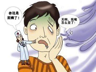顳骨骨折