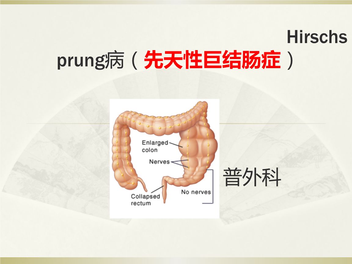 先天性巨結(jié)腸