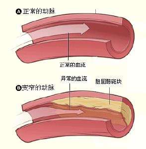 視膜毛細(xì)血管前小動脈