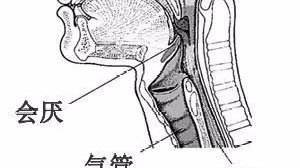 會厭囊腫