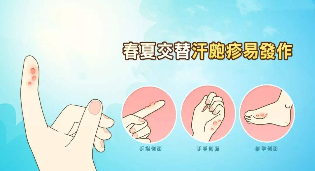 汗皰疹