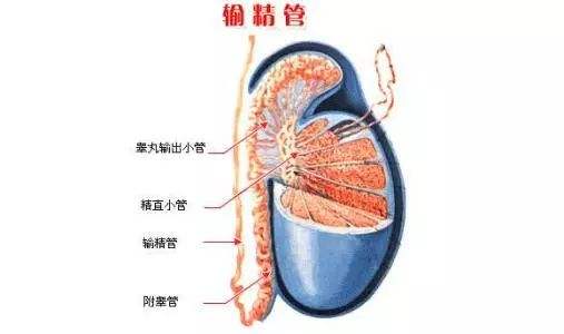 輸精管堵塞