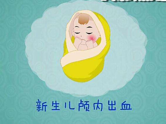 新生兒顱內出血