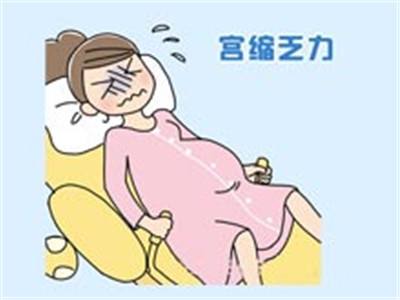 異常分娩