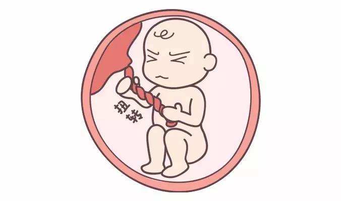 臍帶異常