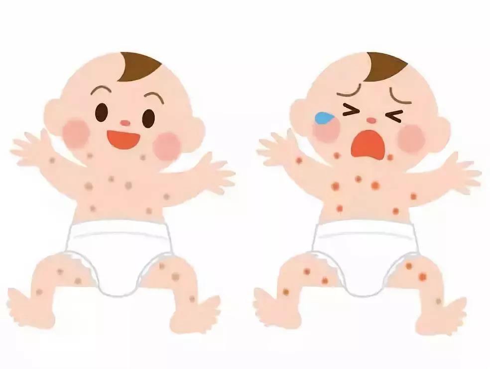 小兒類風濕病