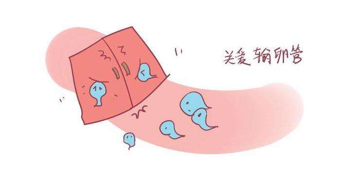 輸卵管堵塞
