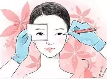 雙眼皮修復