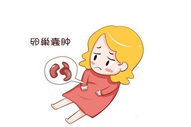 卵巢囊腫