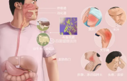 布魯氏菌病